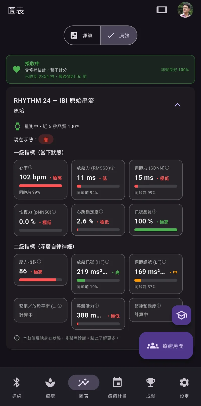 App 的即時指標畫面:心率、RMSSD、SDNN、pNN50 等數值與區間標示